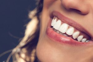 beljenje zob Luxdental