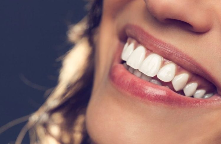 beljenje zob Luxdental