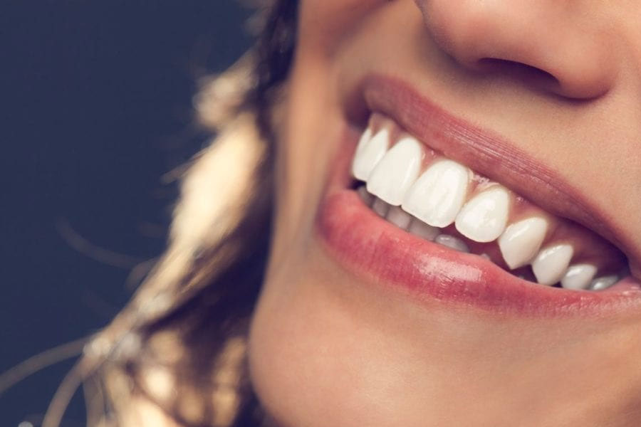 beljenje zob Luxdental